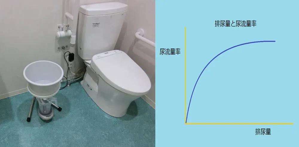 前立腺肥大症の診断方法　｜天王寺　山本クリニック | 安心して通える親しみやすい泌尿器科