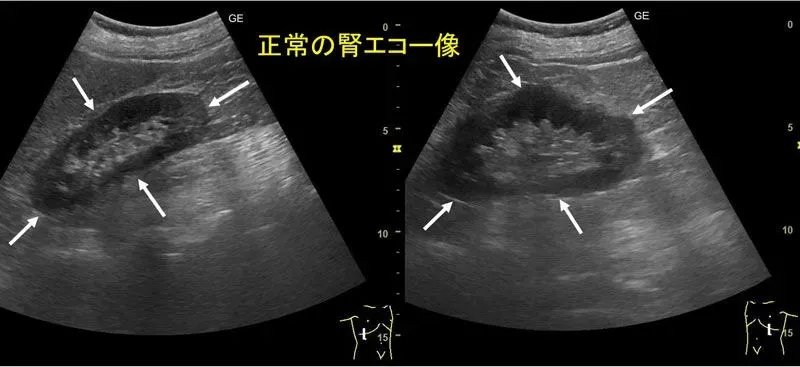 前立腺肥大症の受診時期｜天王寺　山本クリニック | 安心して通える親しみやすい泌尿器科